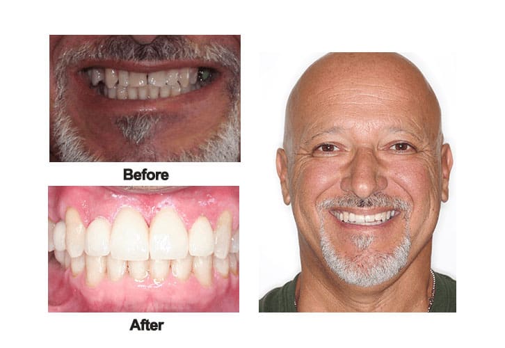 The-Dental-Method-Smile-Gallery-Dental-Before-and-After-Photos-1