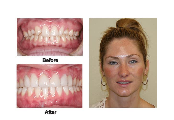 The-Dental-Method-Smile-Gallery-Dental-Before-and-After-Photos-2
